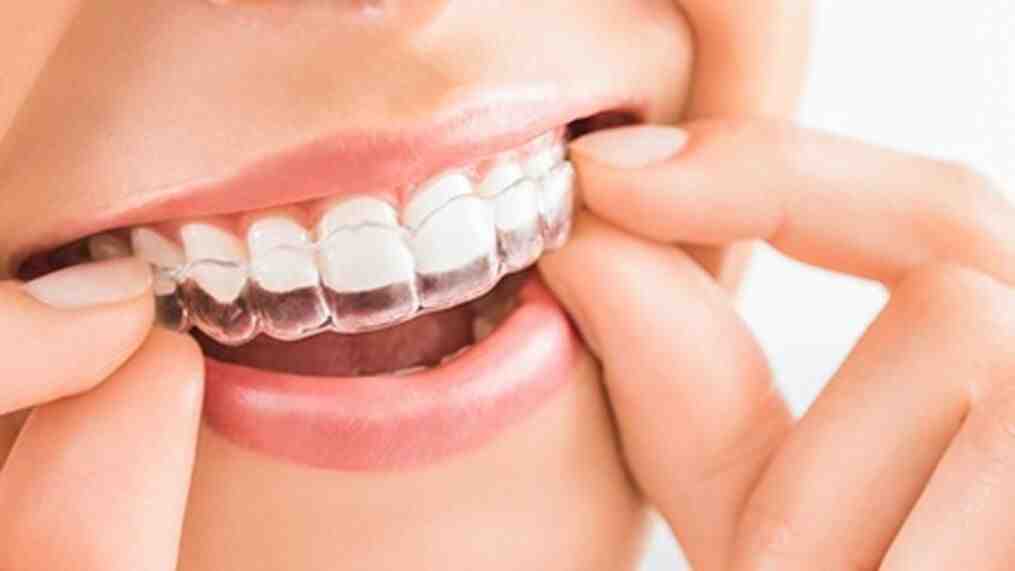 Can rotten teeth make you sick?