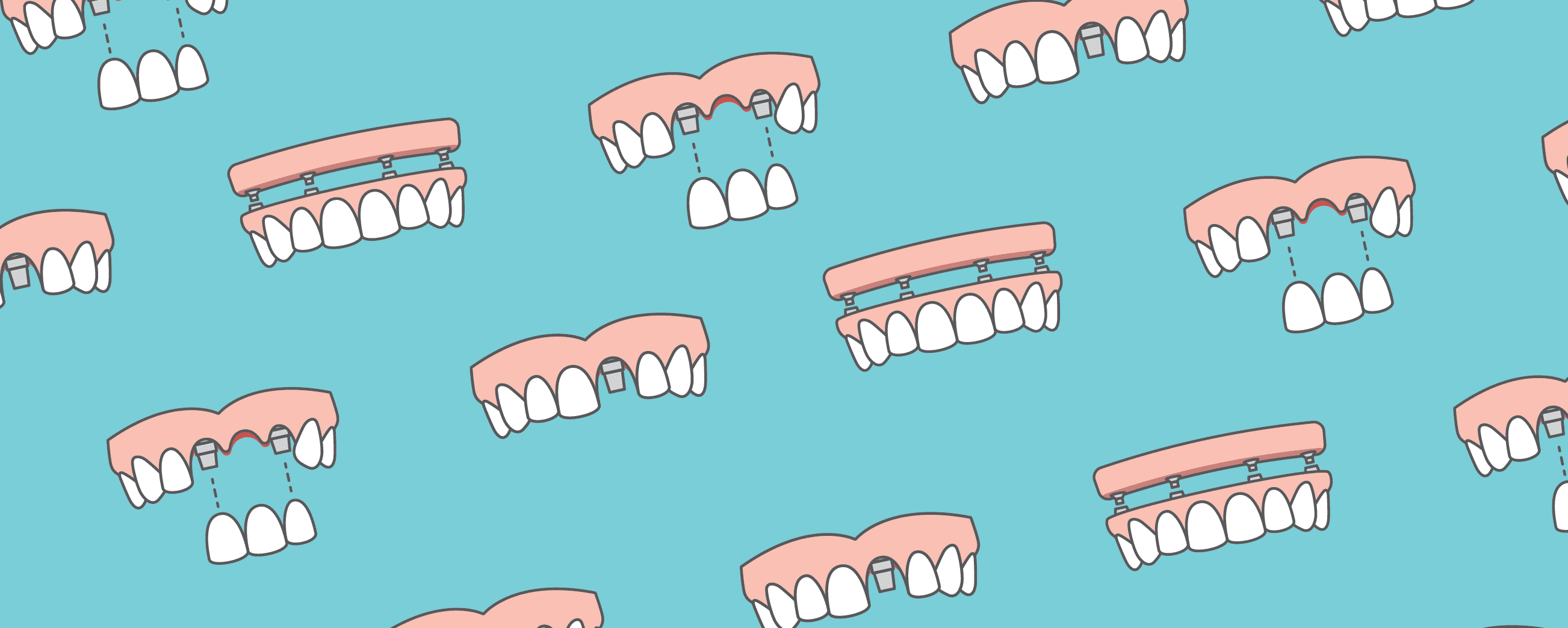 Does Medicaid cover implants?