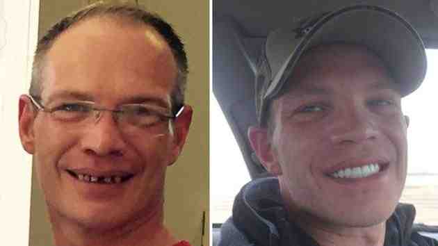 How do you get your teeth fixed when you have no money?