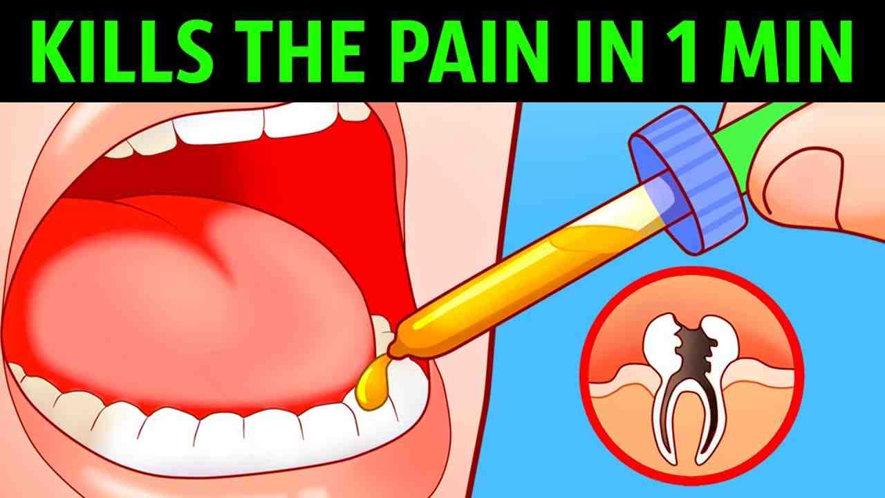 How long does it take the nerve in a tooth to die?