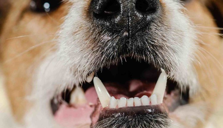 How much does it cost to have all your teeth pulled?