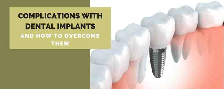 Is missing teeth a disability?