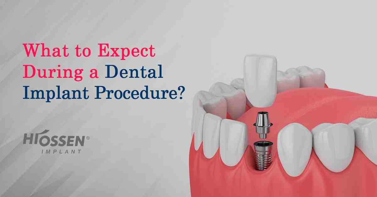 What are the long term effects of dental implants?