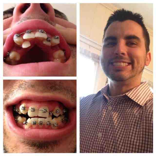 What helps unbearable tooth pain?
