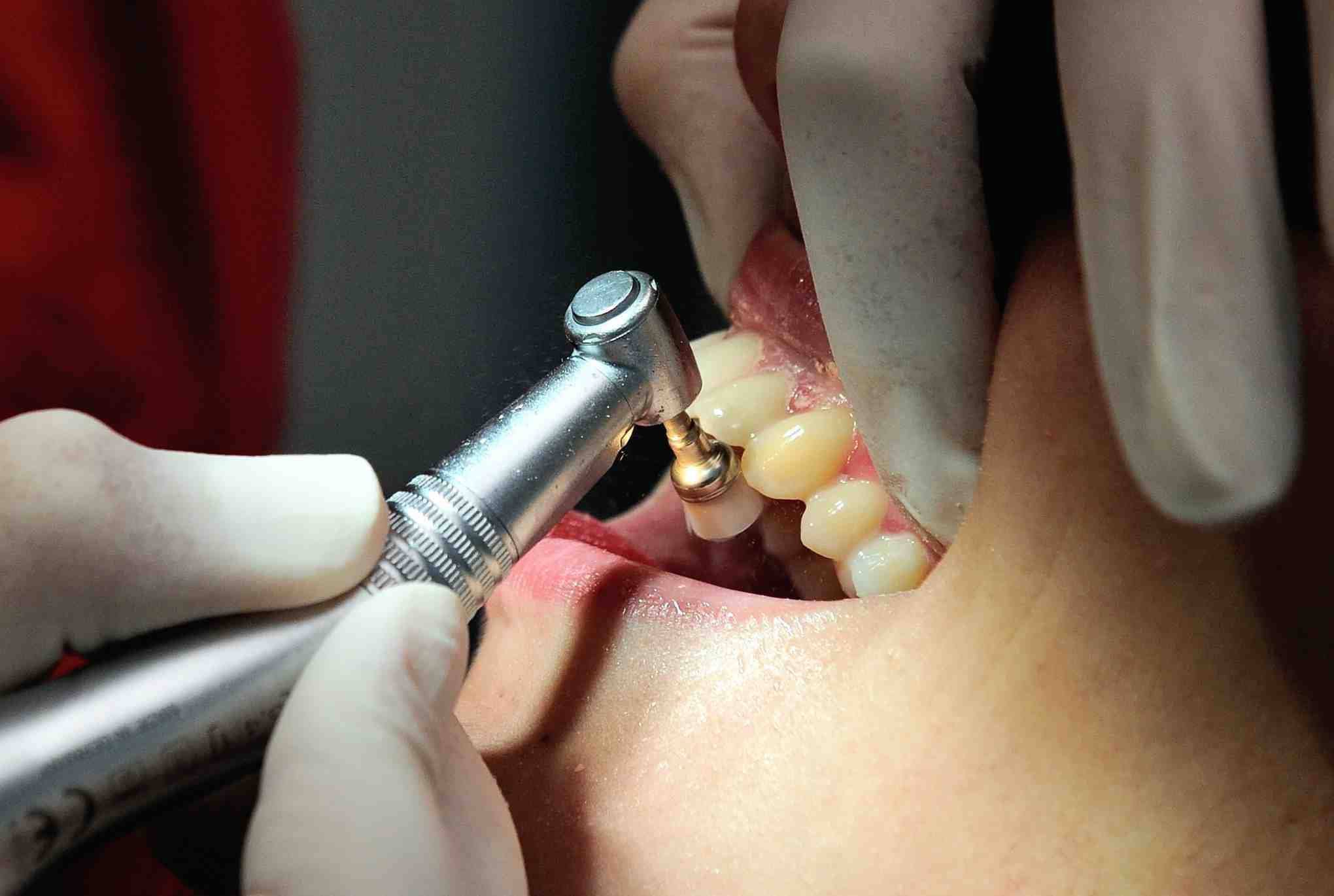What to do if you can't afford to go to the dentist?